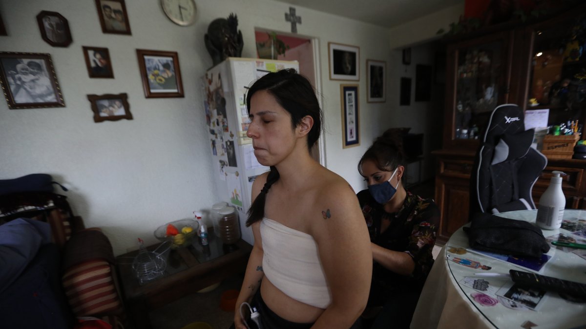 Sandra Monroy (i), recibe ayuda de Gina Ramírez (d), en su habitación el 30 de septiembre de 2021, tres meses después de que se le practicara una masectomía bilateral a causa del cáncer de mama que padecía.