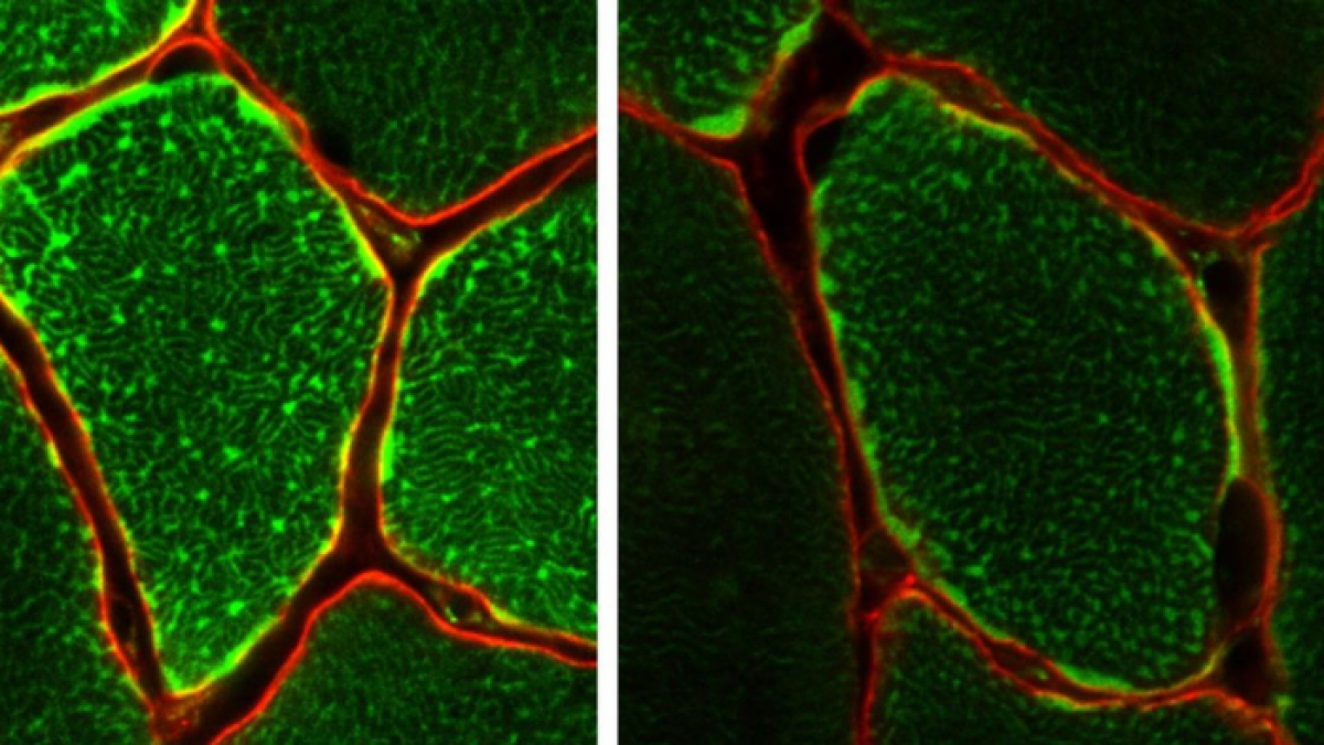 Un equipo de científicos ha identificado una enzima que resulta clave para que el ejercicio mejore nuestra salud. En la imagen, tinción que muestra las mitocondrias dentro de las fibras musculares individuales.