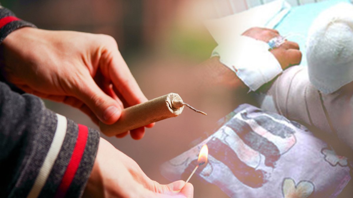 Las fiestas dejaron varios niños quemados por pólvora.