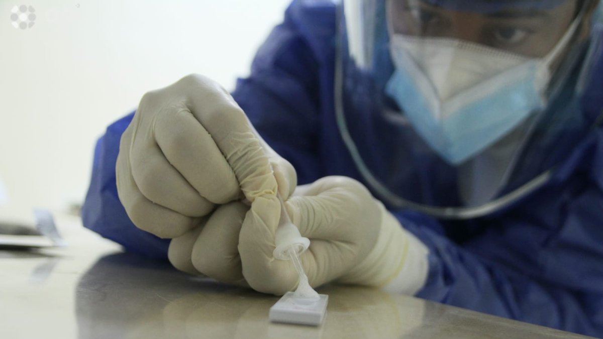 En Ecuador y otros países temen una posible escasez pruebas de Covid-19 en el país. Por ello toman medidas.