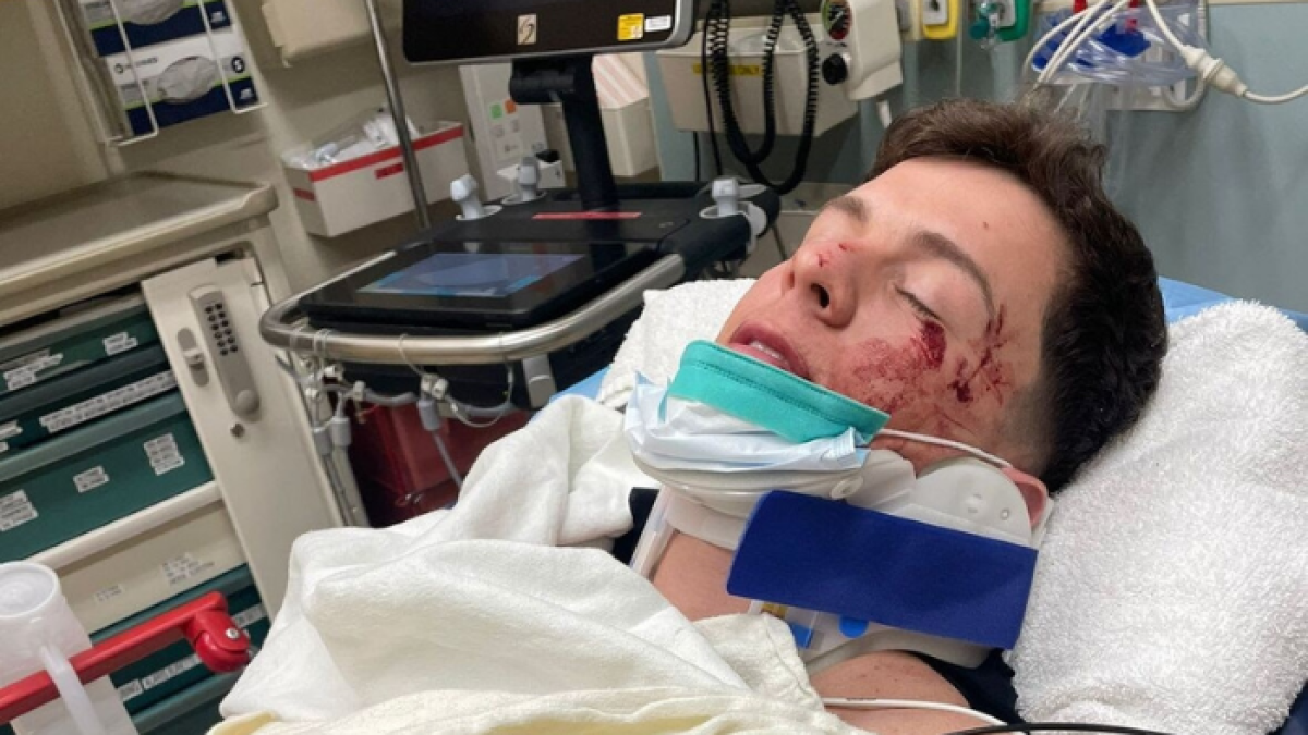 Fotografía cedida por French Toast Agency que muestra al cantante Guaynaa mientras esta ingresado tras un accidente de transporte en Los Ángeles