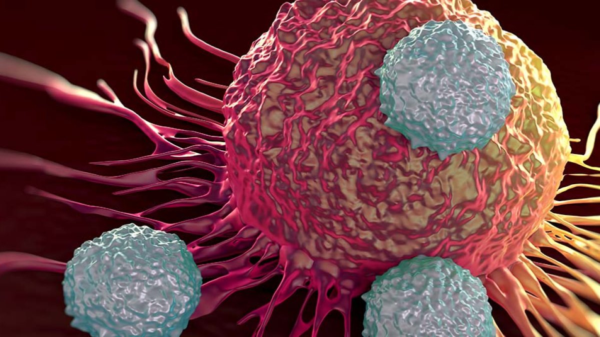 Cada día los investigadores hallan nuevas formas de combatir el cáncer, la segunda causa de muerte en el mundo.