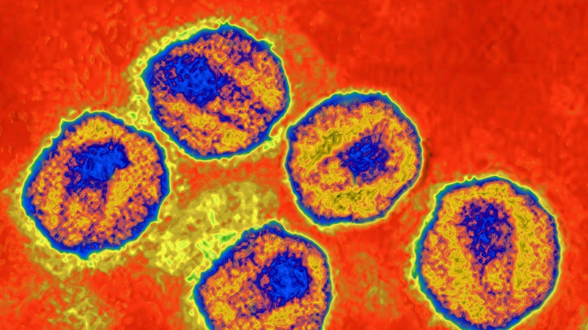 Imagen producida a partir de una imagen tomada con microscopía electrónica de transmisión. / El País
