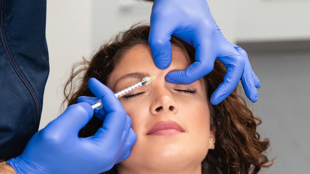 Toxina botulínica preventiva.