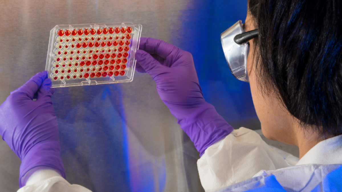 Un estudio dirigido por investigadores de UTHealth Houston (Estados Unidos) ha estudiado los anticuerpos de los niños.