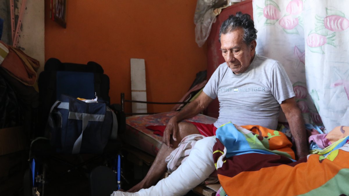 Daño. Desde el 14 de marzo, Reinaldo Acosta permanece con yeso tras caer en una acera, en El Pedregal, en el Guasmo.