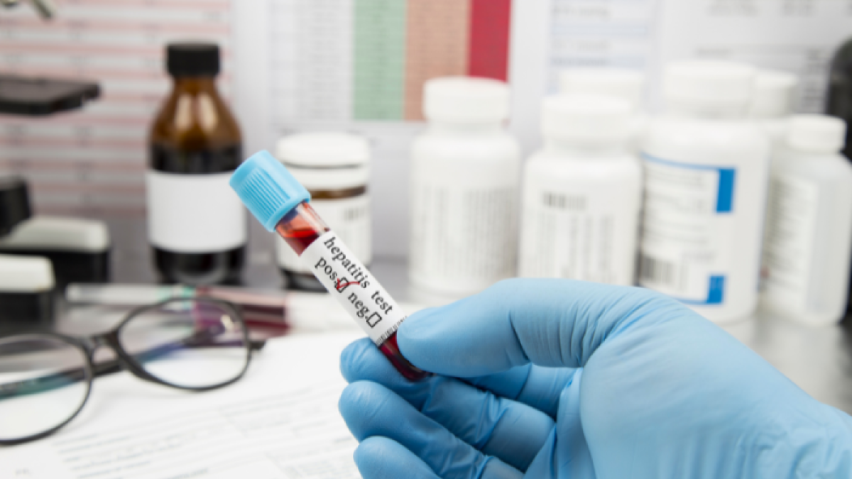 Referencial examen de hepatitis.