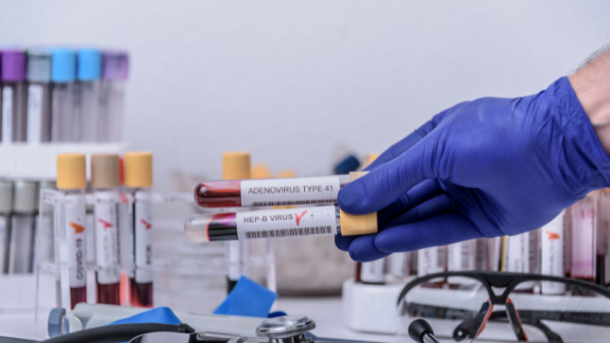 Referencial hepatitis.