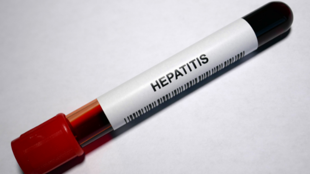 Referencial hepatitis.