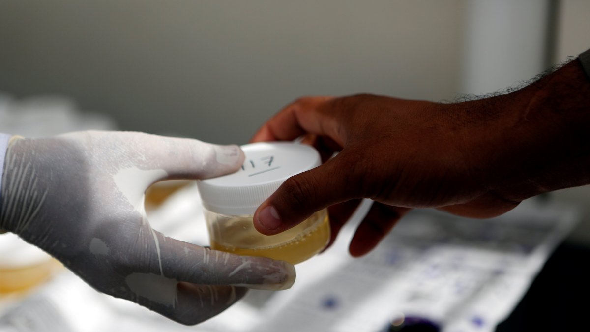 Un equipo científico de Brasil ha desarrollado un test capaz de detectar en la orina la presencia de anticuerpos contra el SARS-CoV-2 con una precisión comparable a las pruebas existentes basadas en suero sanguíneo.