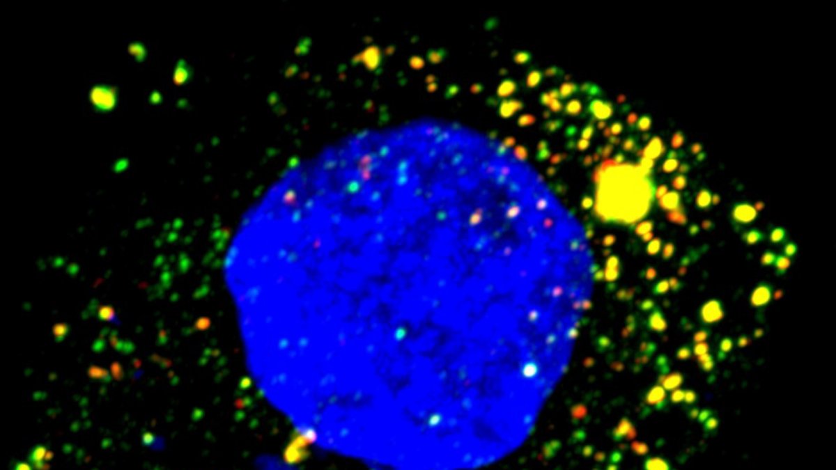 Imagen cedida de microscopía de fluorescencia de una célula hepática humana cultivada infectada por el virus de la hepatitis A.