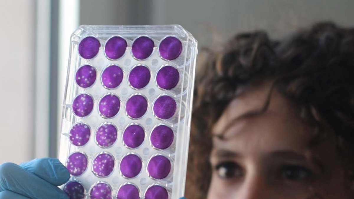 Una de los miembros del equipo, Meriem Bekliz, observa una de las placas usadas para determinar la capacidad de neutralización de los anticuerpos.