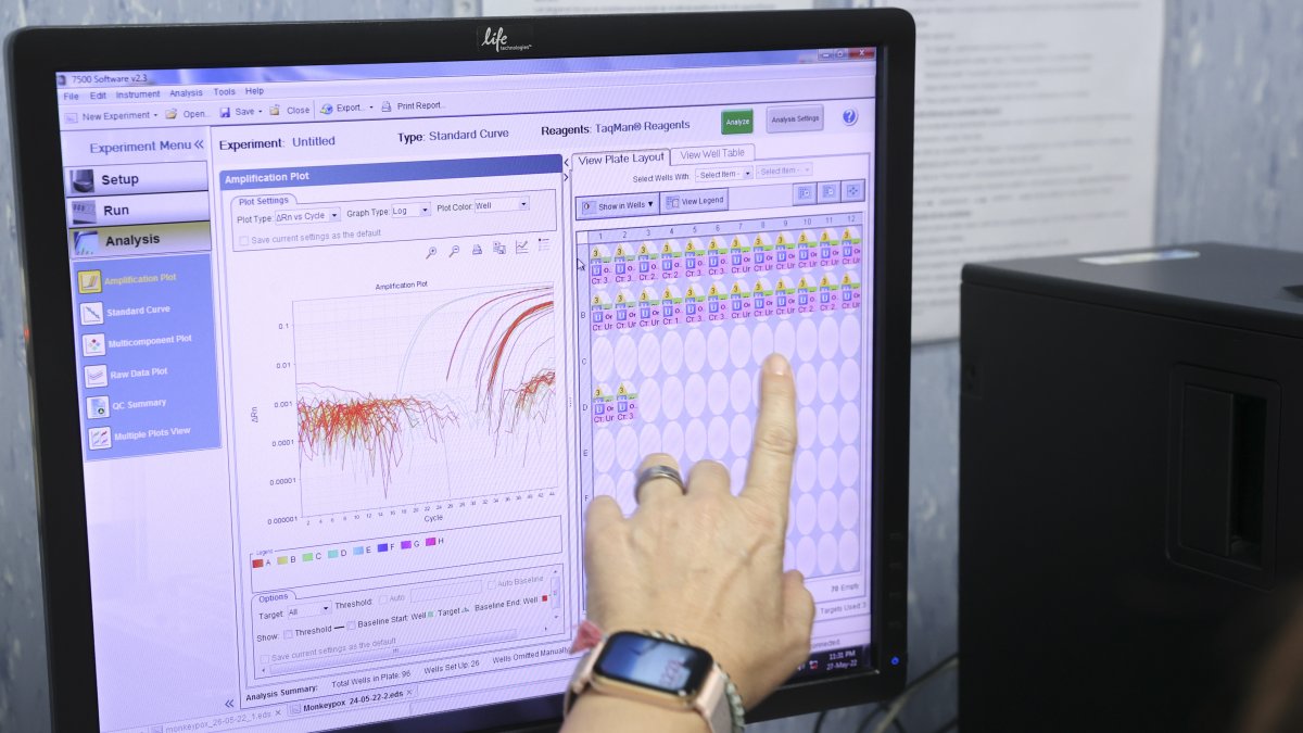 Fotografía de archivo, tomada el pasado 27 de mayo, en la que se registró una pantalla del laboratorio del Centro Nacional de Microbiología de España, en la que se muestra el primer borrador de la secuencia completa del virus causante de la viruela del mono (Monkey Pox) que circula por España a partir de las muestras de 23 pacientes.