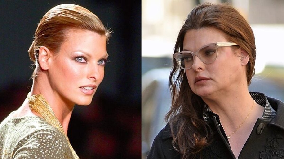 El antes y el después de la modelo canadiense, hoy de 57 años.