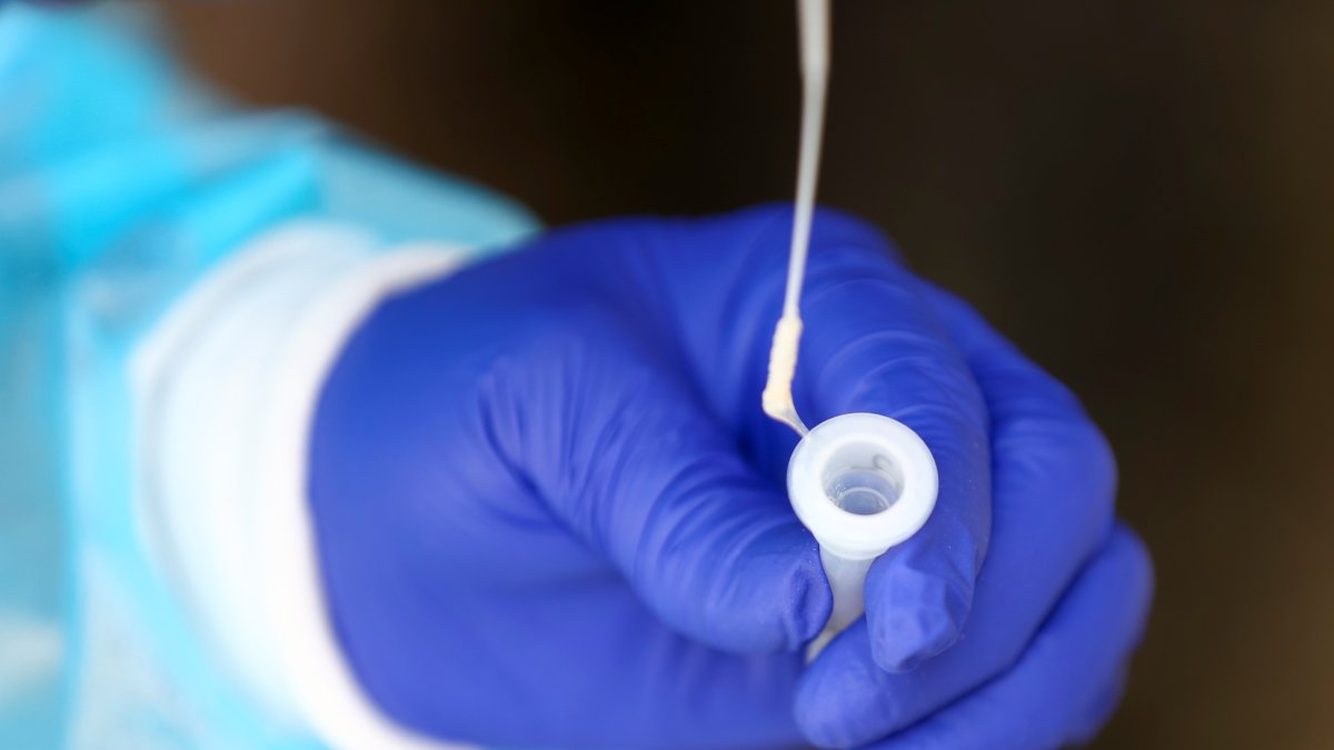 El Ministerio de Salud había indicado que las pruebas rápidas de covid-19 se empezarían a vender en farmacias este miércoles 17 de agosto