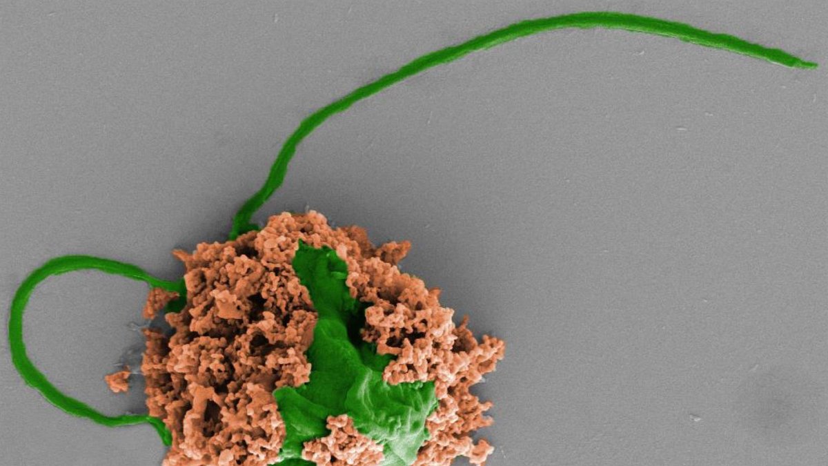 Imagen coloreada de un microrobot que está formado por una célula de alga (verde) recubierta de nanopartículas de polímero biodegradable (marrón).