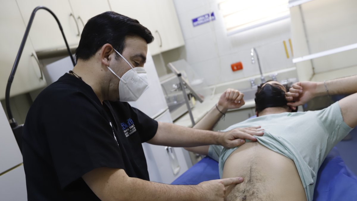 Procedimiento. Resultados de usar toxinas para relajar músculos y facilitar la reconstrucción abdominal.