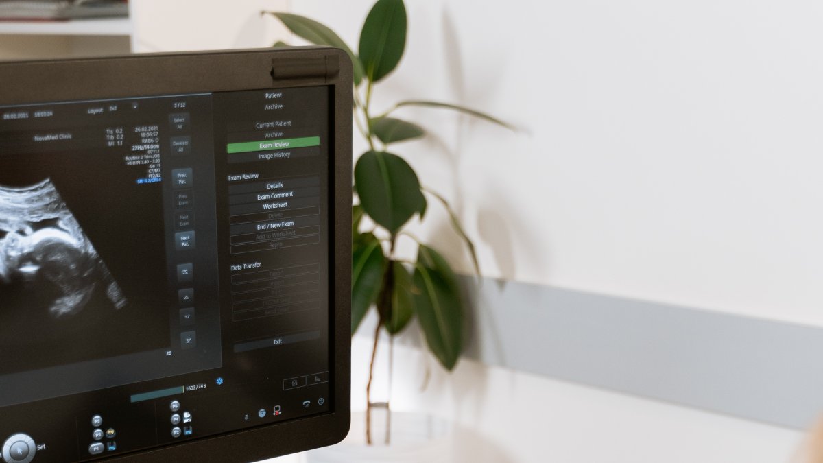 Dato. Hasta un 74 % podría sufrir de hipertensión.
