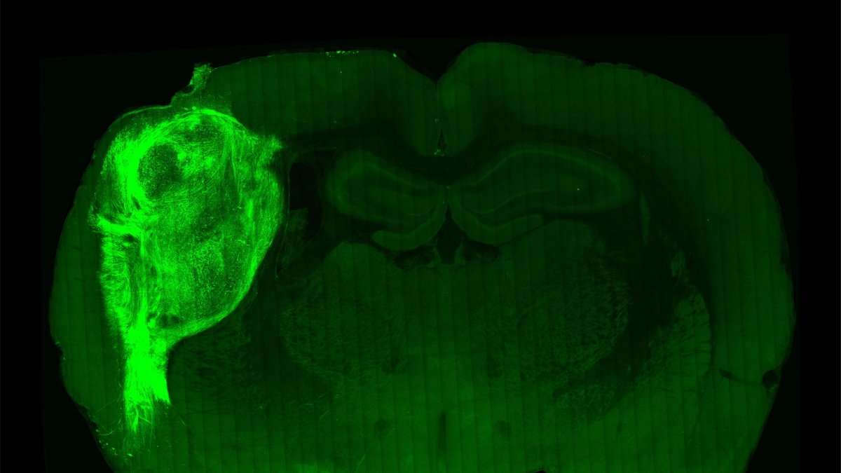 Un organoide humano trasplantado y marcado con una proteína fluorescente en una sección del cerebro de la rata.