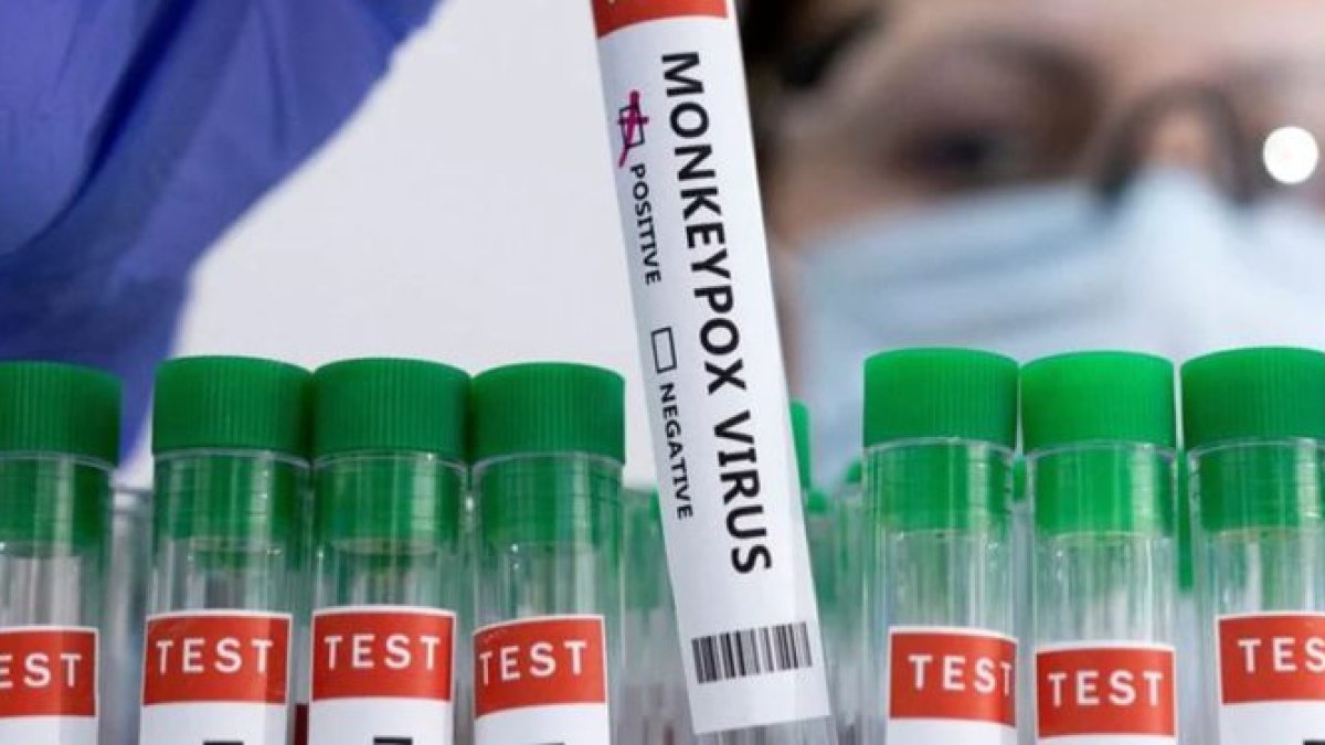 Foto archivo viruela del mono