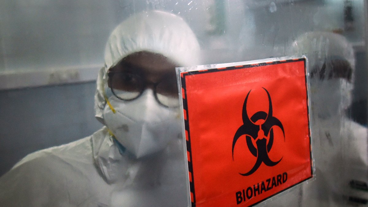 Fotografía de archivo de un laboratorio molecular que analiza pruebas de detección de la viruela del mono.