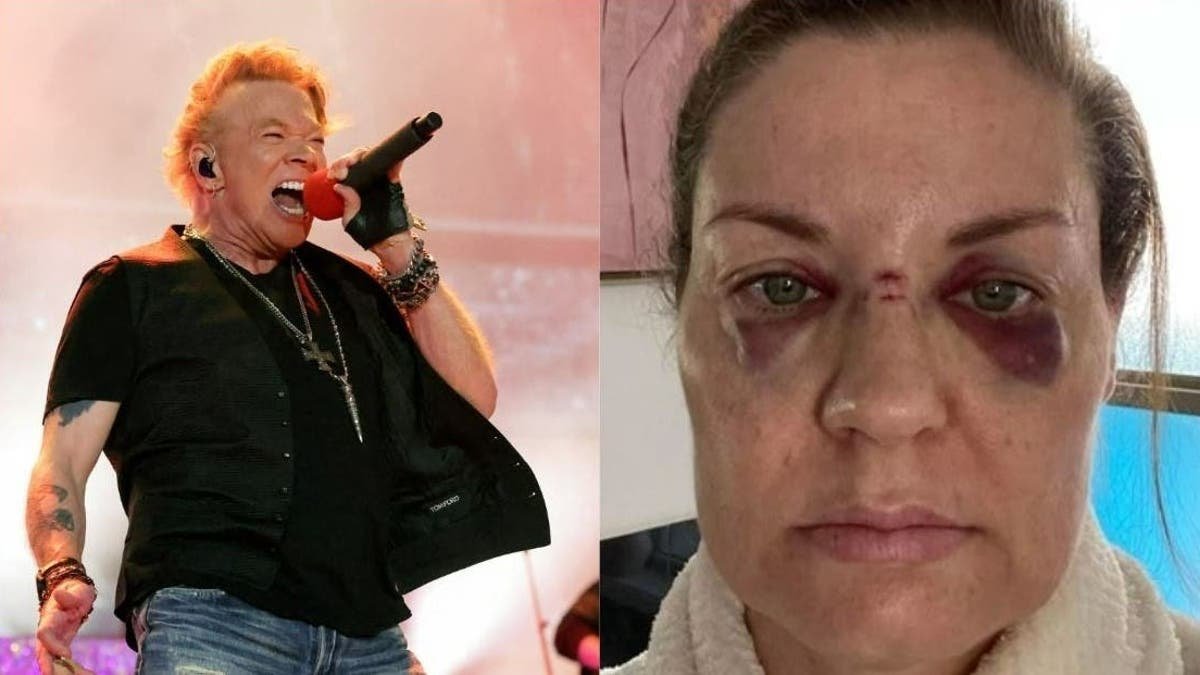 Axl Rose lamenta lo ocurrido a una de sus admiradoras, pero aclara que lanzar el micrófono es un 'ritual' practicado hace más 30 años.