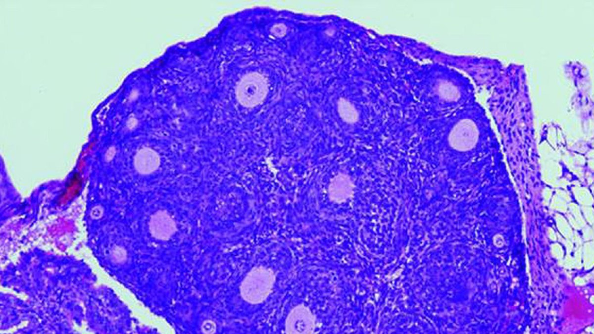 El equipo trabajó con ratones a los que conectó unos electrodos en miniatura para grabar simultáneamente en dos regiones del cerebro.