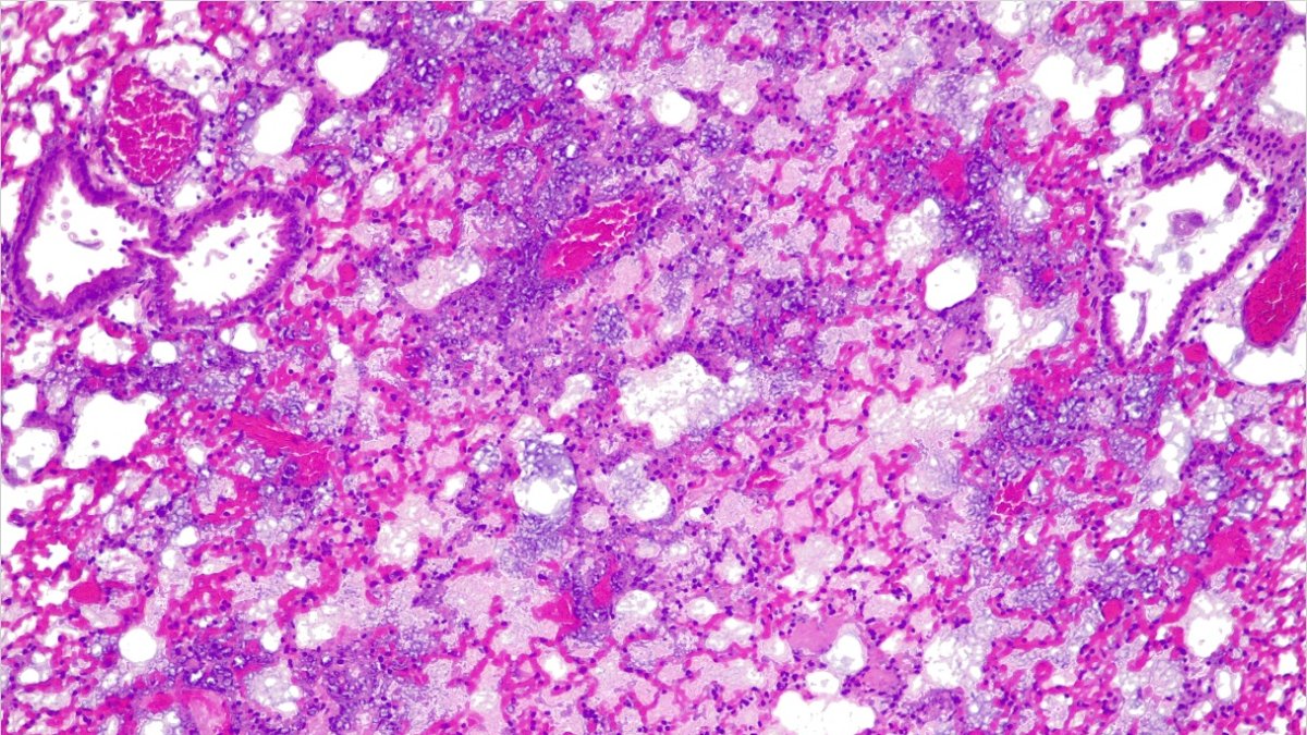 Pulmones de ratón sin píldora activa.