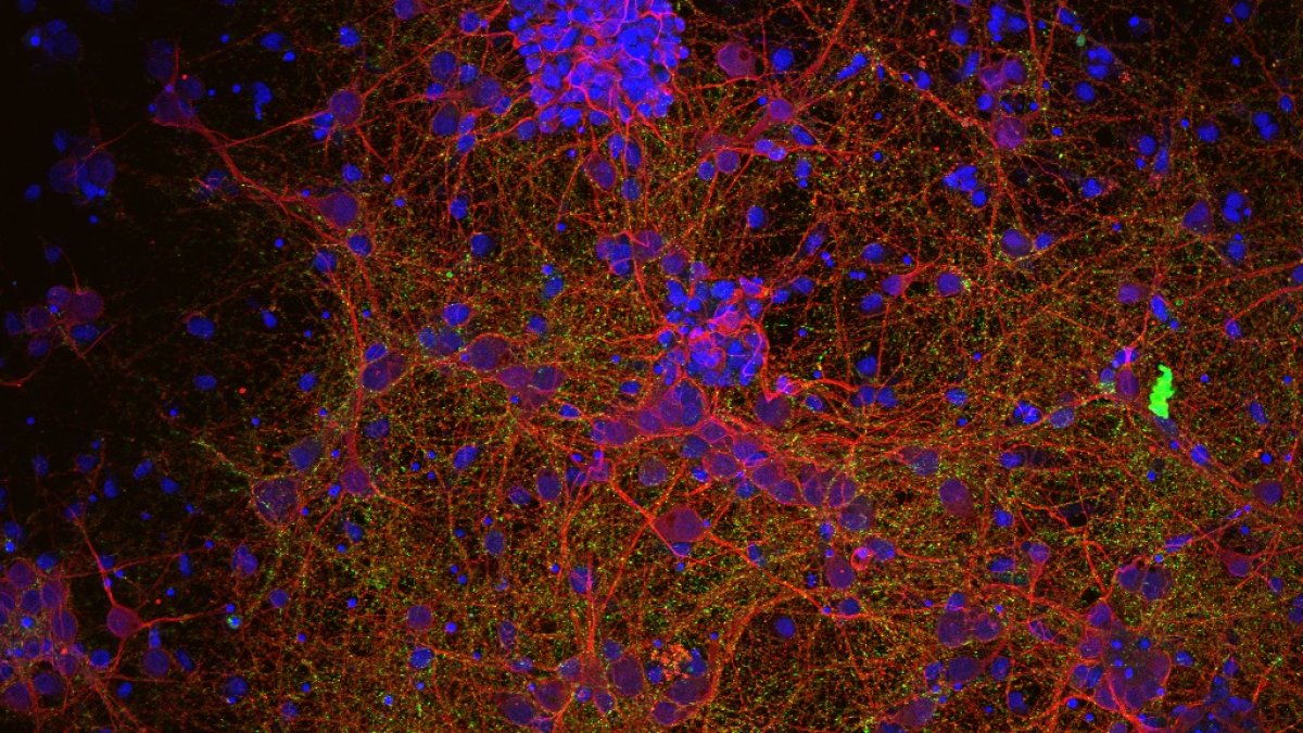 Centros de investigación de seis países europeos han lanzado un proyecto pionero en el mundo para tratar de encontrar tratamientos eficaces contra las lesiones medudalares.