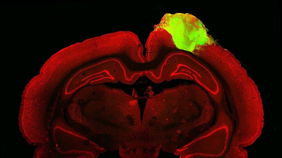 Imagen histológica de un cerebro de rata con un organoide cerebral humano injertado.