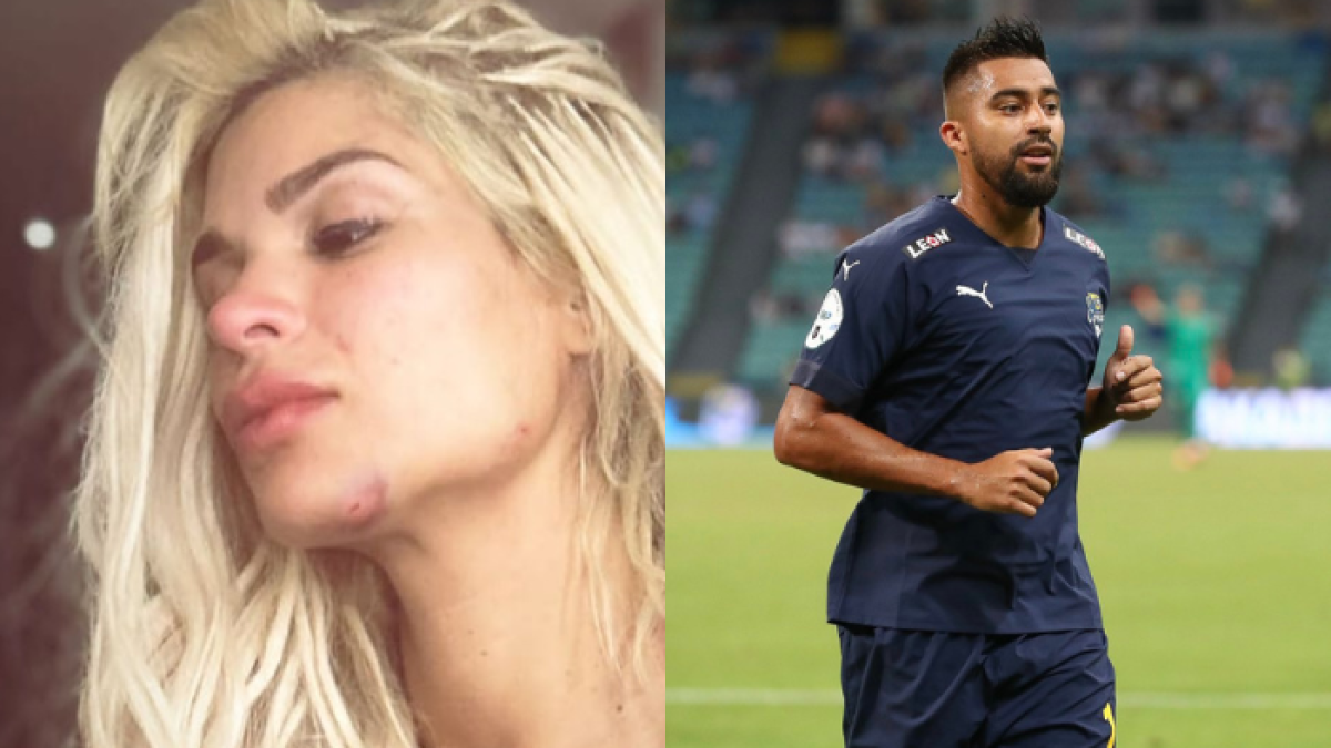 En las imágenes publicadas por la modelo se observa su rostro golpeado y con raspones