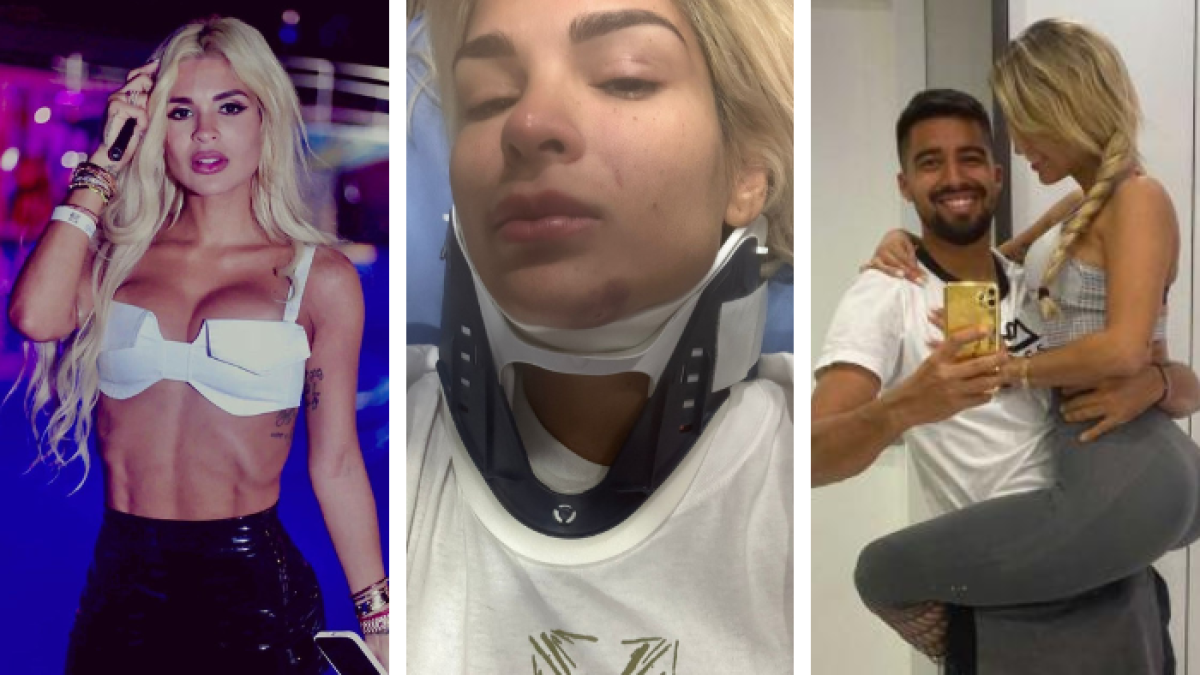 Keviam Cazon compartió con Expreso una foto en la que lleva collarín.