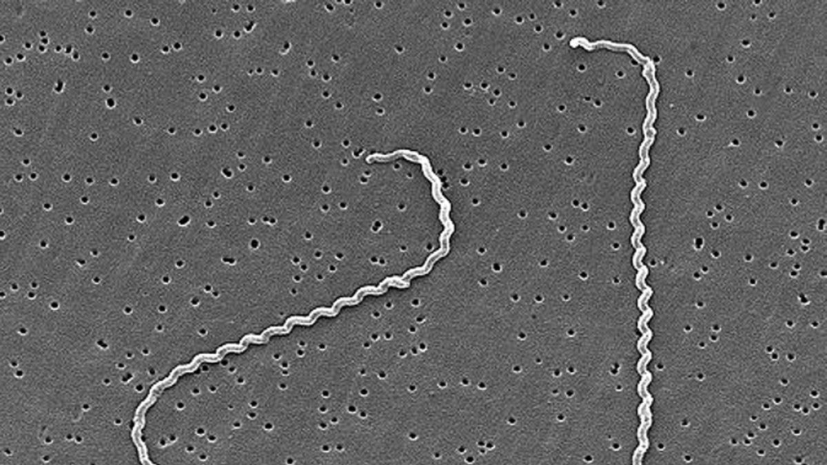 La Leptospira es la bacteria causante de esta enfermedad.