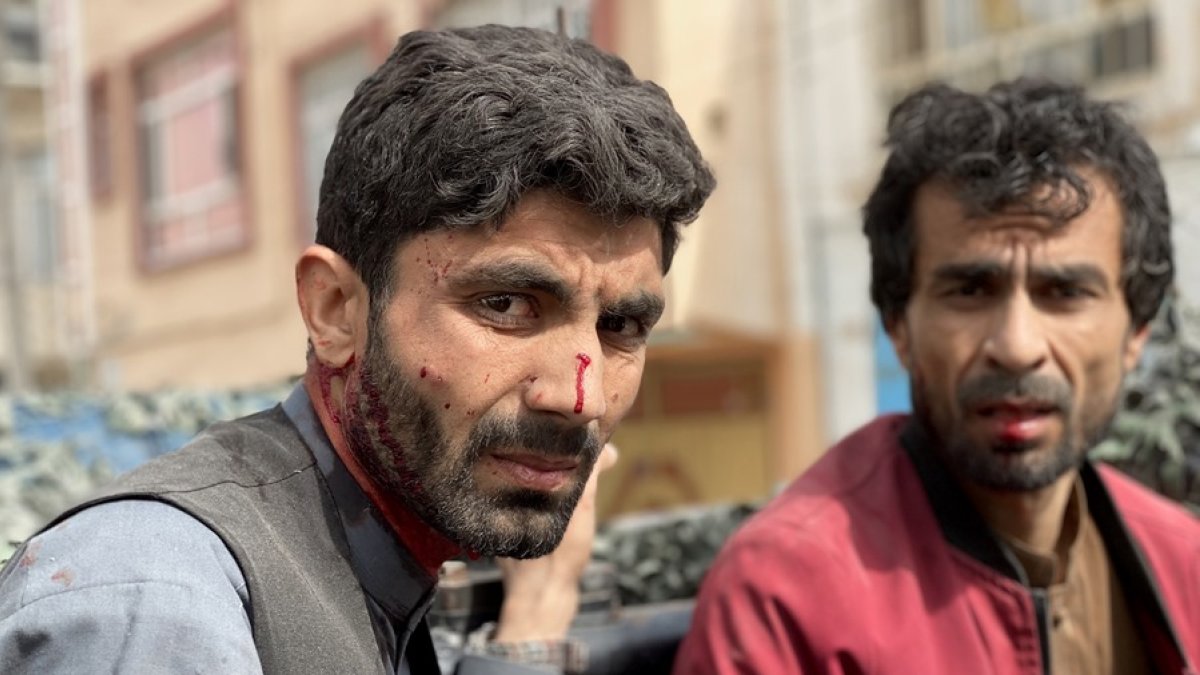 Dos de los periodistas heridos en el atentado.