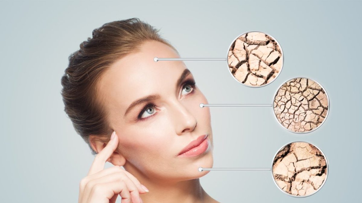 Cuando los síntomas de piel seca se prolongan lo más adecuado es acudir al dermatólogo
