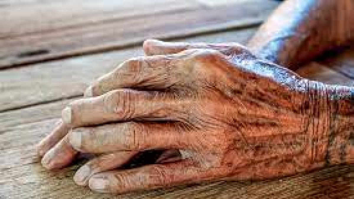 Evidencia. La piel envejecida  cicatriza deficientemente.