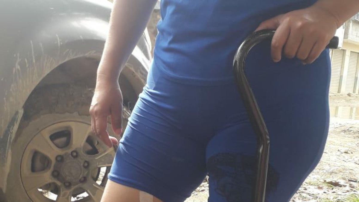 La periodista está estable, pero con un disparo en la pierna