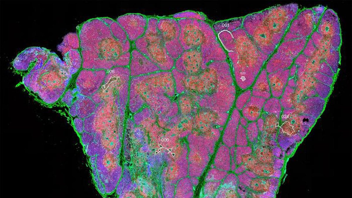 Sección de tejido completo de un timo humano después del nacimiento, que muestra timocitos (rojo), células epiteliales (cian) y células madre junto a zonas de fibronectina (verde).