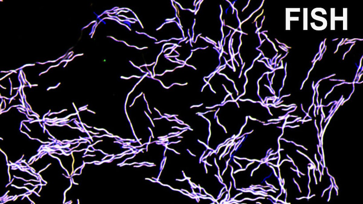 Vista de microscopio fluorescente de Taurinivorans muris (