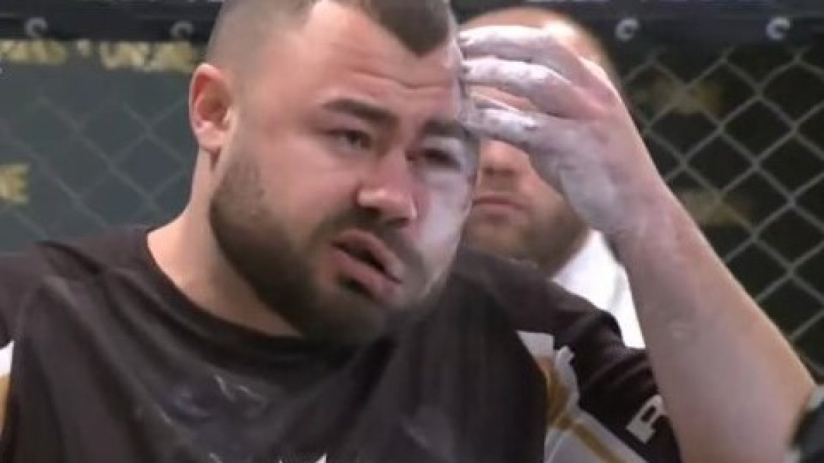 En una competencia en enero, el rumano Sorin Comsa no se dejó ganar en una competencia de bofetadas, terminando con el rostro hinchado y ensangrentado