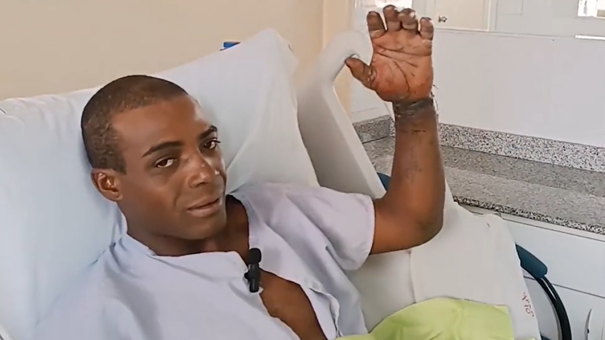 A Bryan Benet le reimplantaron su mano en el hospital Pablo Arturo Suárez.