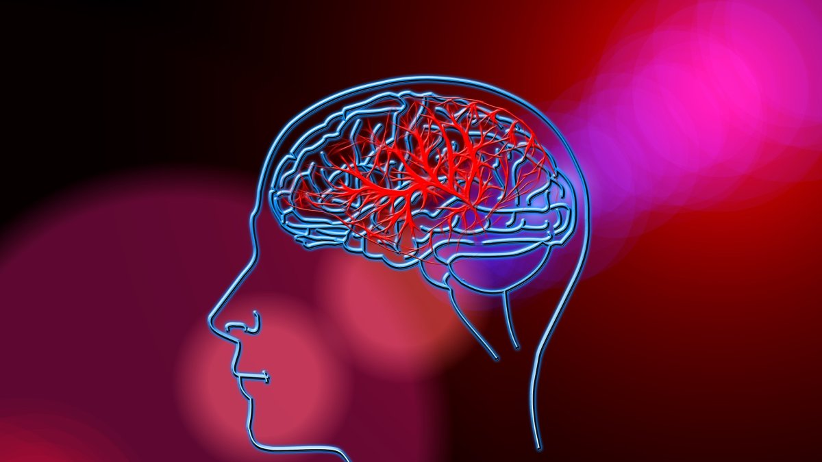 Ante un ACV acuda inmediatamente al hospital.