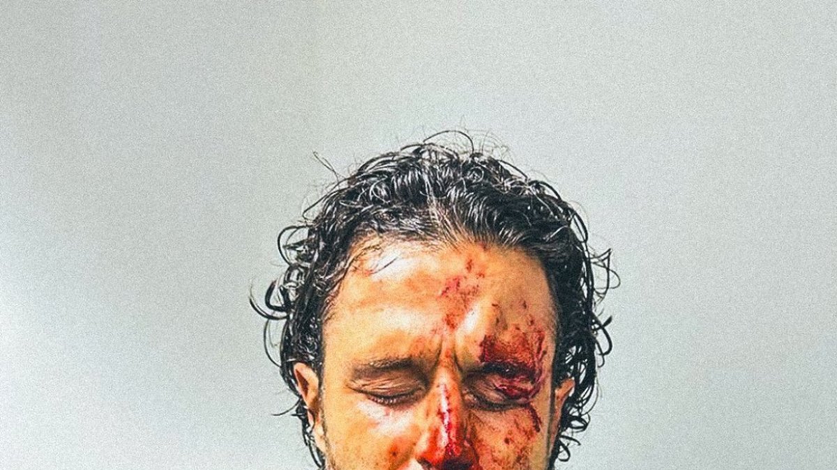 Hirieron en la cabeza al técnico visitante, el italiano Fabio Grosso.