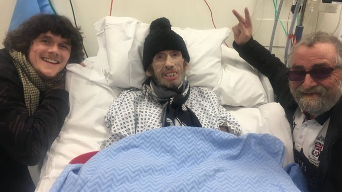 Shane MacGowan también perdió gran parte de dentadura y su salud se deterioró en los últimos años tras una vida de excesos.