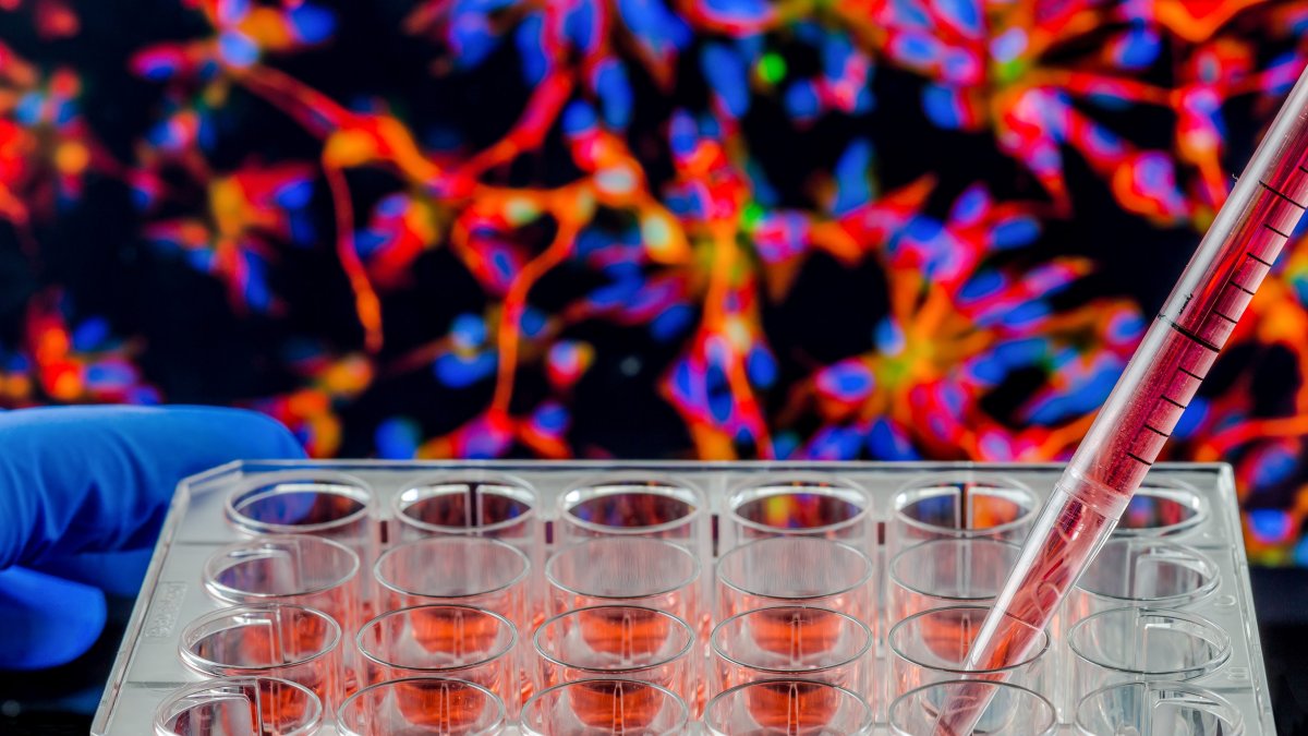 Imagen referencial. Medicina.