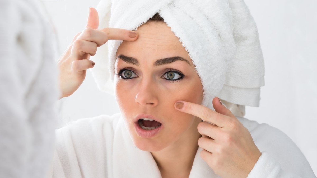 El estrés puede aumentar la producción de grasa y con ello, la aparición de acné.