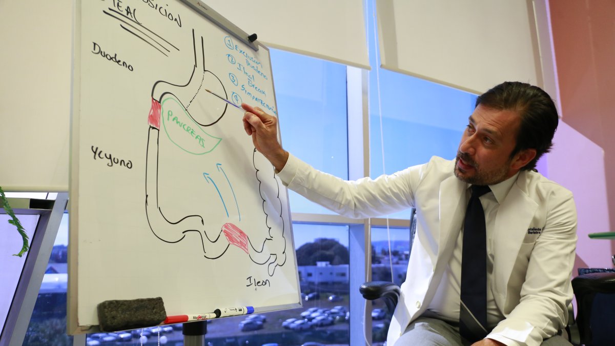 El doctor José Antonio Castañeda, habla sobre los beneficios del proceso quirúrgico