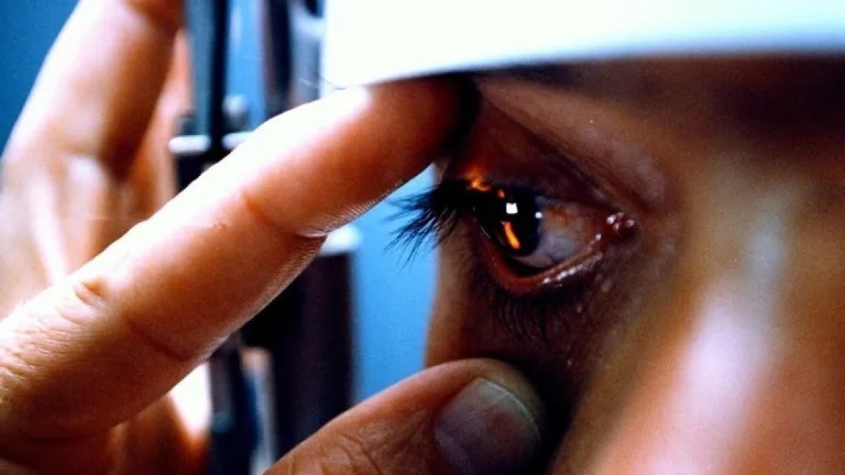 Situación. El queratocono es una enfermedad rara en las córneas del ojo.