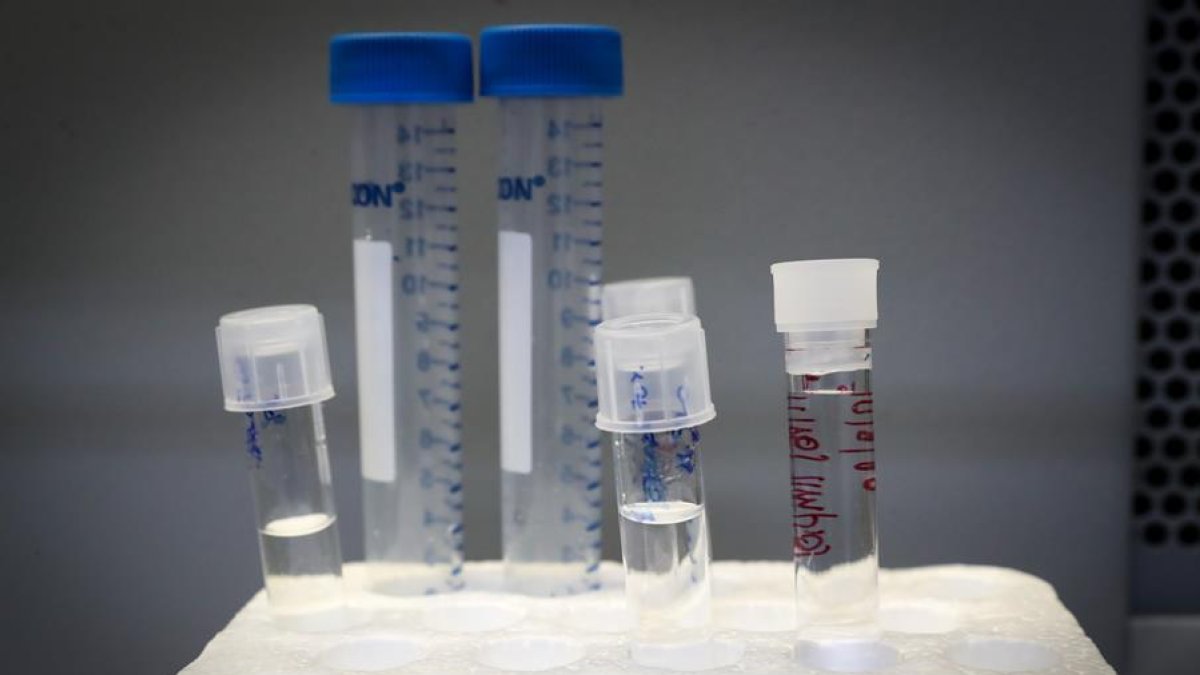 Estudio.- El bisfenol, un químico escondido con consecuencias para la salud.