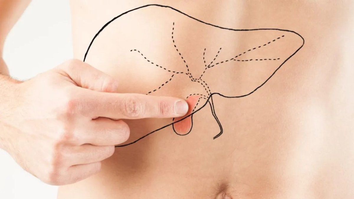 Muestra. Síntomas cambiantes y exclusivos en pacientes